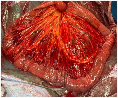 Retrospective analysis of postoperative complications following surgical treatment of ileal impaction in horses managed with manual decompression compared to jejunal enterotomy